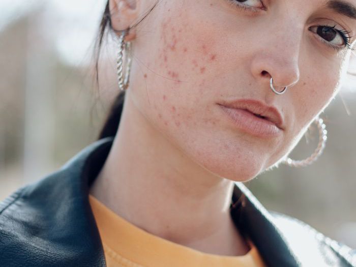 When Is It Advisable to Make Use of best scar cream After Rhinoplasty?